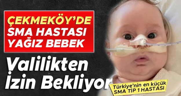 Çekmeköy'de SMA hastası Yağız bebek, valilikten izin bekliyor